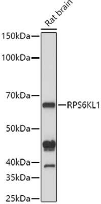 Western Blot: RPS6KL1 Antibody [NBP3-04434] - Western blot analysis of extracts of Rat brain cells, using RPS6KL1 antibody (NBP3-04434) at 1:1000 dilution. Secondary antibody: HRP Goat Anti-Rabbit IgG (H+L) at 1:10000 dilution. Lysates/proteins: 25ug per lane. Blocking buffer: 3% nonfat dry milk in TBST. Detection: ECL Basic Kit. Exposure time: 10s.